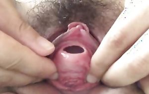 Ass fucking interview insertion into the urethra